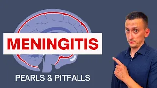 BACTERIAL MENINGITIS IN ADULTS: SYMPTOMS, CAUSES, DIAGNOSIS, AND TREATMENT