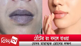 ঠোঁটের রং বদলে যাওয়া যেসব মা*রা*ত্ম*ক রোগের লক্ষণ । Bijoy TV