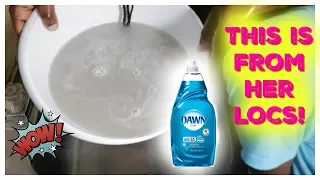 How To Remove Dirt and Buildup with Dawn Dish Soap! /Locs