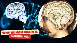 The Mystery of Shrinking Brains in Modern Humans | Why Is It Happening?