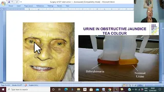 Biliary  disorders in Arabic 14  ( Obstructive jaundice , part 2 ) , by Dr. Wahdan