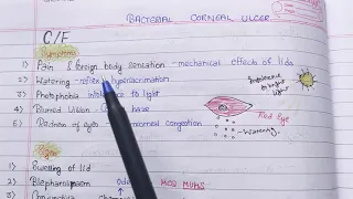 Keratitis Part 2  bacterial corneal ulcer theory notes ( AK KHURANA)