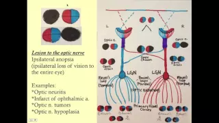 Neuro-opthalmology - CRASH! Medical Review Series