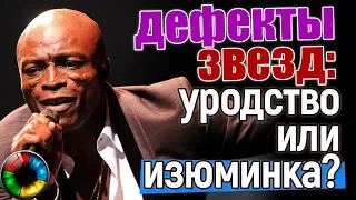 Звезды с дефектами: уродство или изюминка? #уродство #звезда #Голливуд #дефект