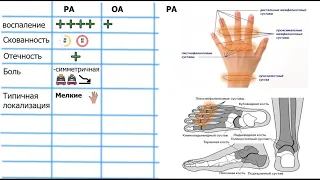 дифференциальная диагностика артритов