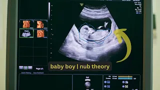 Ultrasound showing baby boy | 3D &  4D | #ultrasound