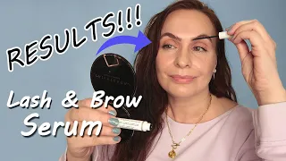 1 Full Year Later: The Ordinary Lash + Brow Serum Success Revealed