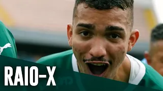 RAIO-X DAS CRIAS: RUAN RIBEIRO