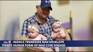 Middle Tennessee man develops human case of mad cow disease