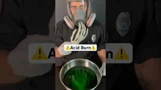 Burned by acid? Try this… #survival #health #medical