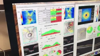 Using Optical Coherence Tomography To Evaluate The Optic Nerve and Nerve Fiber Layer