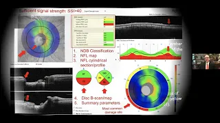 Advances in OCT for Glaucoma by Joel S. Schuman, MD, FACS | UCI CTVR