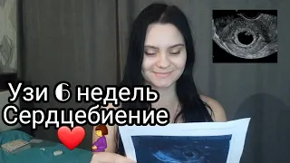 ❤ УЗИ 6 недель беременности I сердцебиение 🤰БЕРЕМЕННА ПОСЛЕ ЭКО