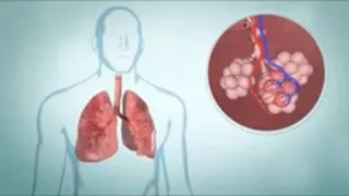 How to cope with Chronic obstructive Pulmonary disease (COPD): Treatment