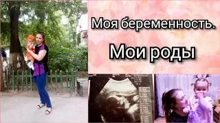 Моя история беременности. Пункция плодного пузыря. Мои роды.