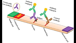 Demystifying Lateral Flow Assay Diagnostic Kit