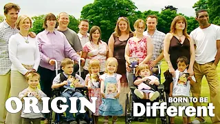 Meet The Incredible Children Born With Disabilities | Born To Be Different | Part 4 | Origin
