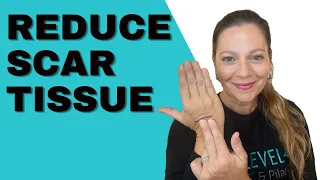 How To Reduce Scar Tissue After Abdominal Surgery | 4 Scar Tissue Mobilization Exercises