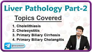 Liver Pathology : Cholelithiasis, Cholecystitis, Primaribiliary Cirrohosis and Cholangitis