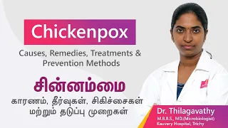 Chicken Pox - Symptoms, Causes, Prevention, Treatment & Awareness | Tamil