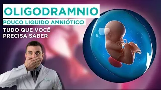 Oligodrâmnio - Bebê com pouco Líquido Amniótico