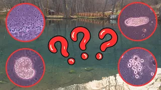 10 Microscopic Organisms I Found in a Drop of Pond Water