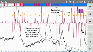 Осознанное сновидение в прямом эфире и "затылочный артефакт"