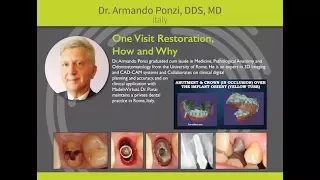 Osseodensification: One Visit Restoration, How and Why - Dr. Armando Ponzi