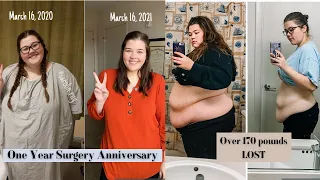 One Year Surgery Anniversary | Gastric Bypass | Weight Loss Journey