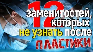 12 знаменитостей, ставших неузнаваемыми после пластики лица