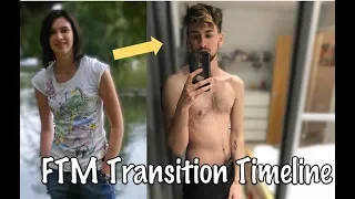 FTM Transition 7 Years on Testosterone