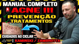 MANUAL COMPLETO CONTRA ACNE: PREVENÇÃO, TRATAMENTOS E OUTRAS DICAS. | ZAMBROTTA & KAMINSKI