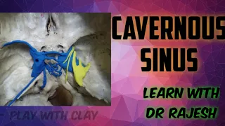 cavernous sinus anatomy