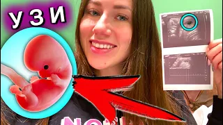 ВТОРОЕ УЗИ 7 Недель 👼🏼 МАЛЬЧИК ИЛИ ДЕВОЧКА ? Я Беременна | Elli Di