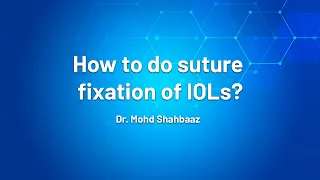 Walk in patient in your OPD : How to do suture fixation of IOLs - Dr Mohd  Shahbaaz