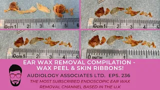 EAR WAX REMOVAL COMPILATION - WAX PEEL & SKIN RIBBON - EP236