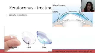 Lecture: Optometry to the Extreme: How We Manage Our Extreme Cases