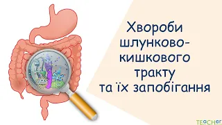 Хвороби шлунково-кишкового тракту та їх запобігання