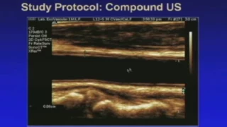 Advanced Sonography of Carotid Arteries Lecture in English