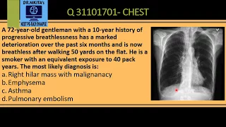 CHEST X RAY- EMPHYSEMA/ COPD SIGNS