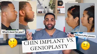 Chin Implant vs. Genioplasty