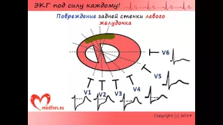 Урок 10. Видеокурс "ЭКГ под силу каждому" + КНИГА!!!