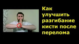 Как улучшить разгибание кисти после перелома