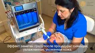 Звездный уход для лица Hydra Facial в Воронеже