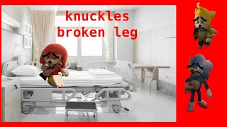 Sonic plush knuckles broken leg