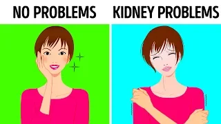 10 Signs Your Kidneys Aren’t Working Properly