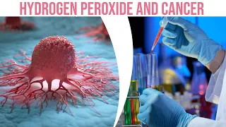 Hydrogen Peroxide And Cancer Is What You Must Know