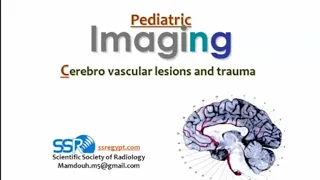 Imaging of pediatric Brain CVS and trauma (I) (DRE) Prof. Mamdouh Mahfouz