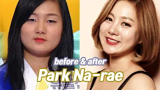 Park Na-rae before and after