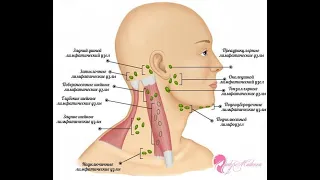 Дифференциальная диагностика лимфаденопатий